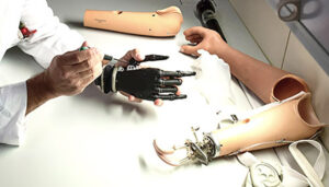 L’esilarante storiella del braccio di silicone e del cervello fino