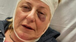 Lesbofobia. Donna presa a calci, spinta giù dalle scale e presa a pugni… Orribile maschilismo