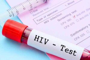 Alessandria. Affrontare l’HIV. Un incontro